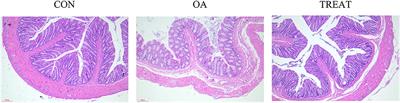 Oral administration of live combined Bacillus subtilis and Enterococcus faecium alleviates colonic oxidative stress and inflammation in osteoarthritic rats by improving fecal microbiome metabolism and enhancing the colonic barrier